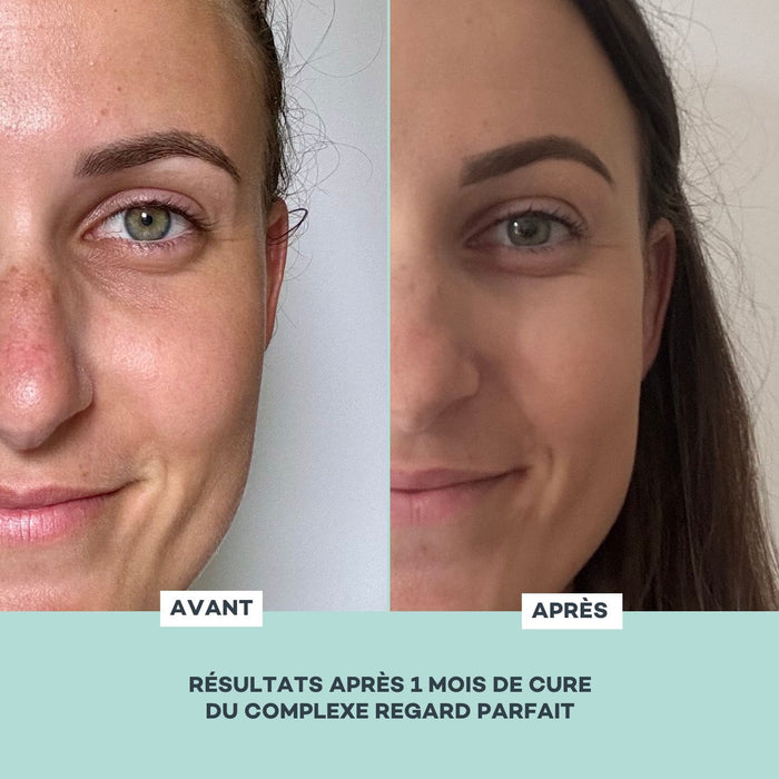 Perfect Look Complex