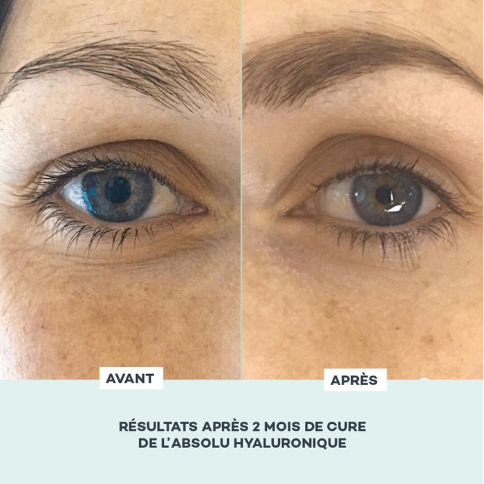 gelules acide hyaluronique