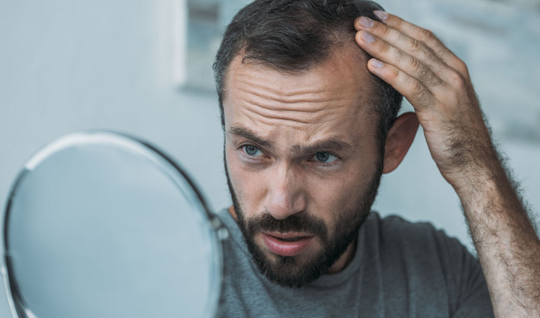 perte de cheveux homme