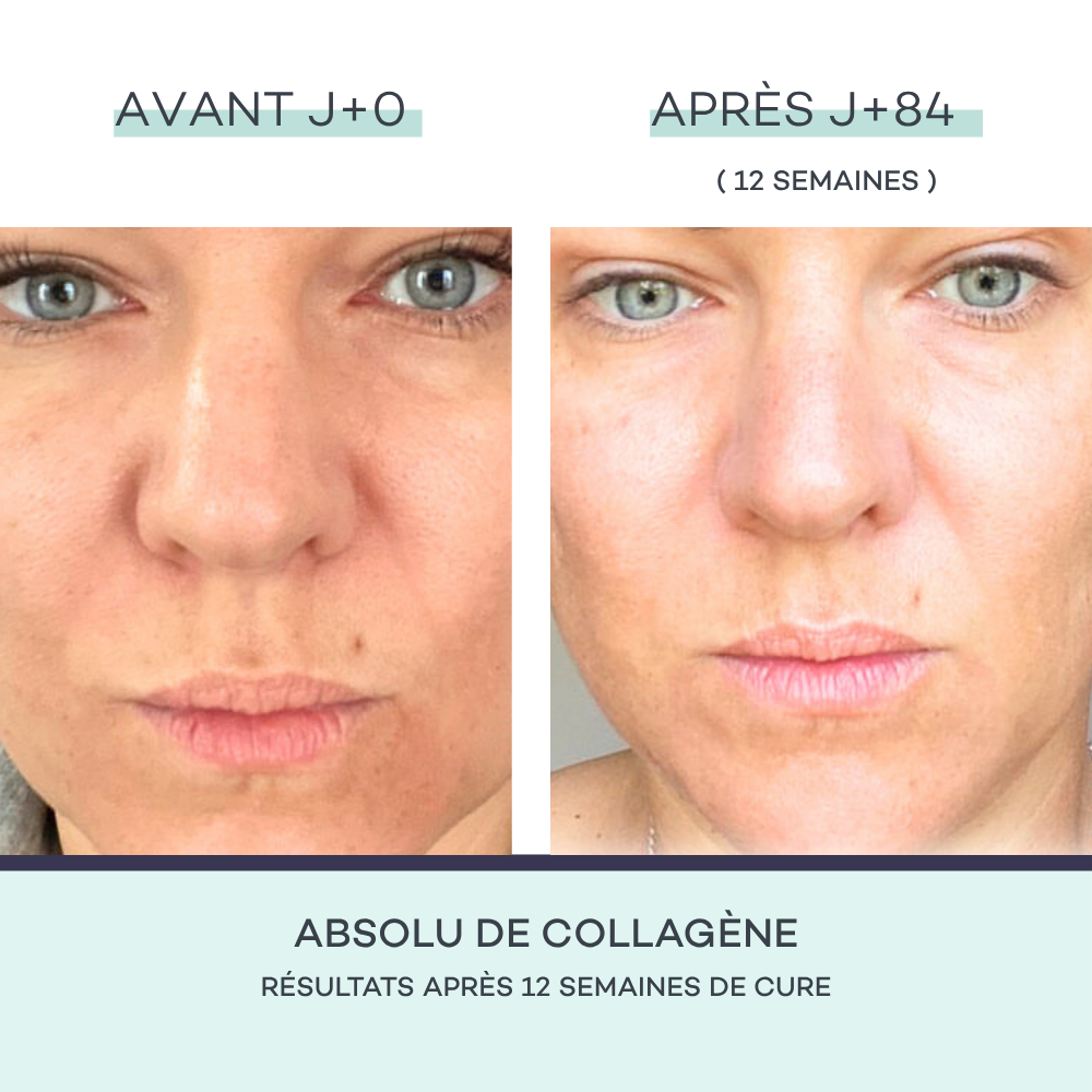 Collagen Absolute