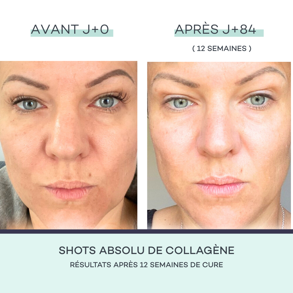 Collagen Shots
