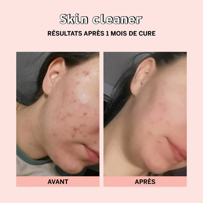 Skin Cleaner - Clearance Stop Ref