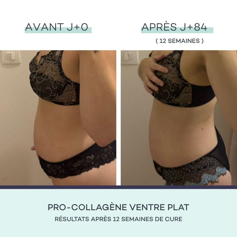 Slimming Set - Mango