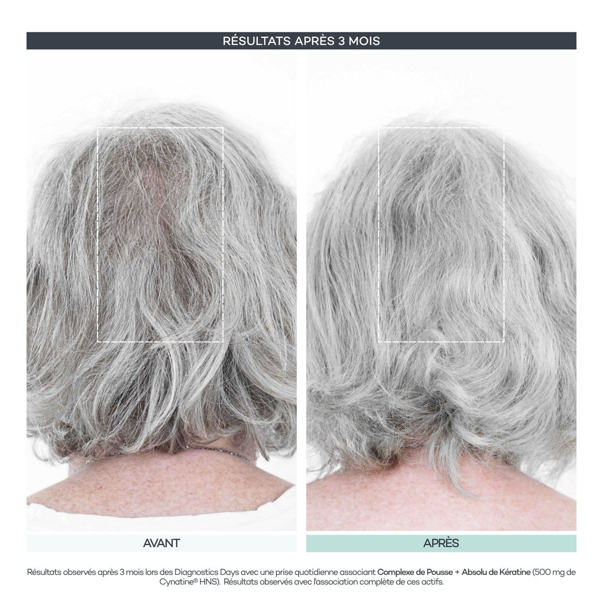 Routine Nutrition-Hair