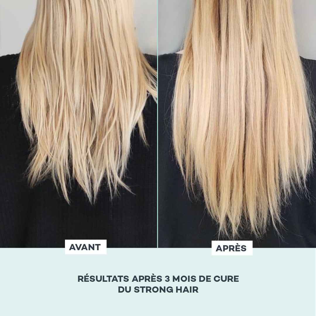 Strong Hair – Gummies