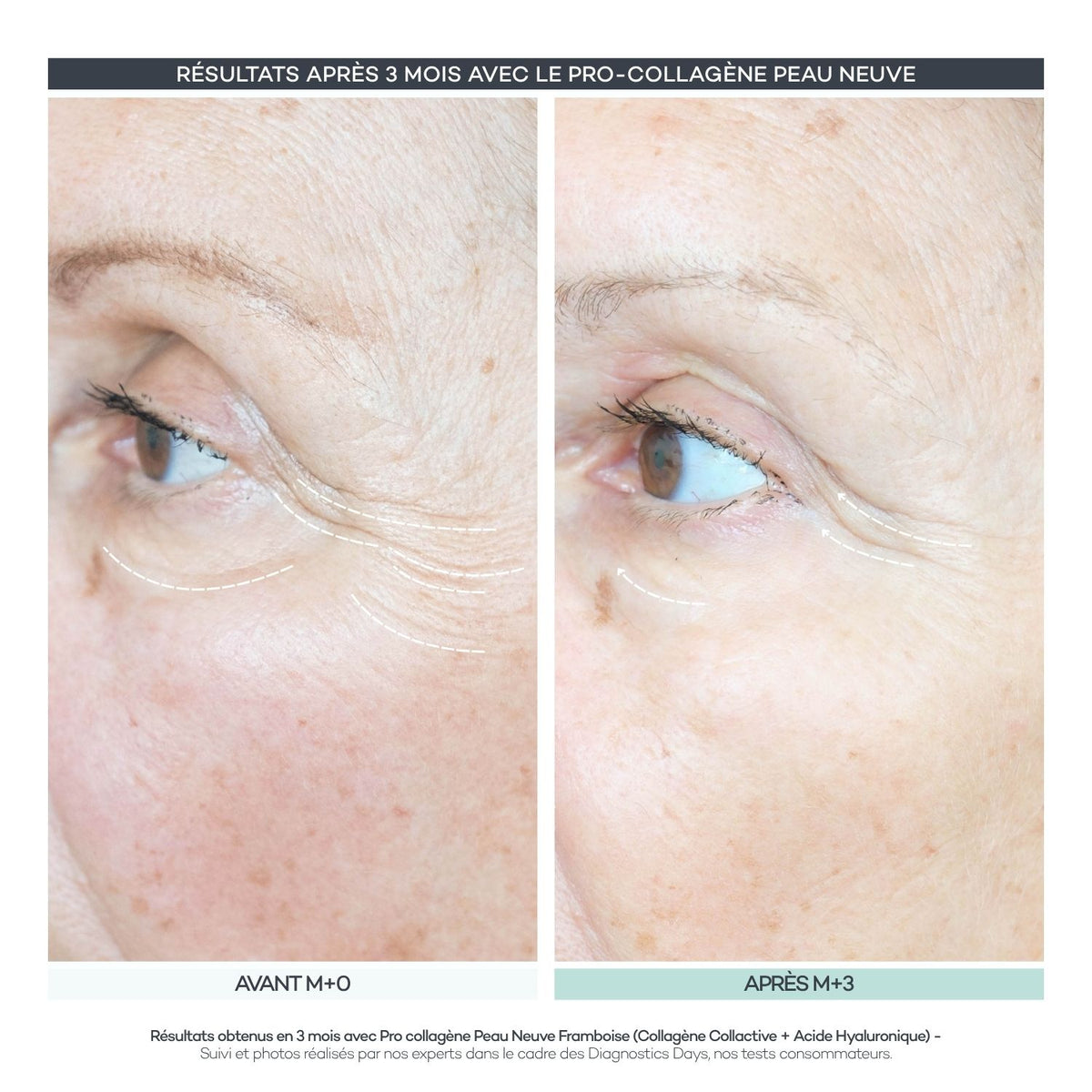 Pro-Collagen New Skin 28 Sticks