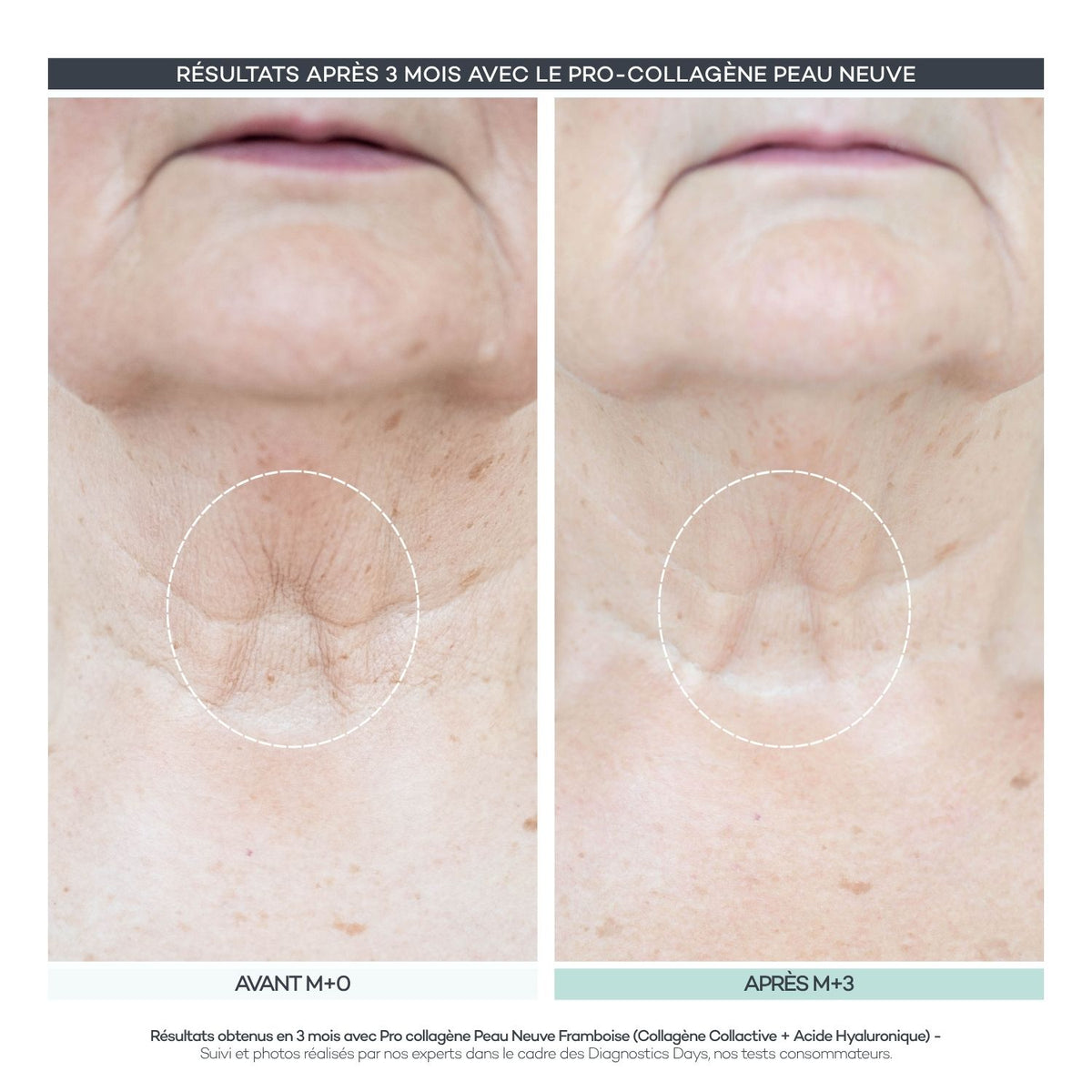 Pro-Collagen New Skin 28 Sticks