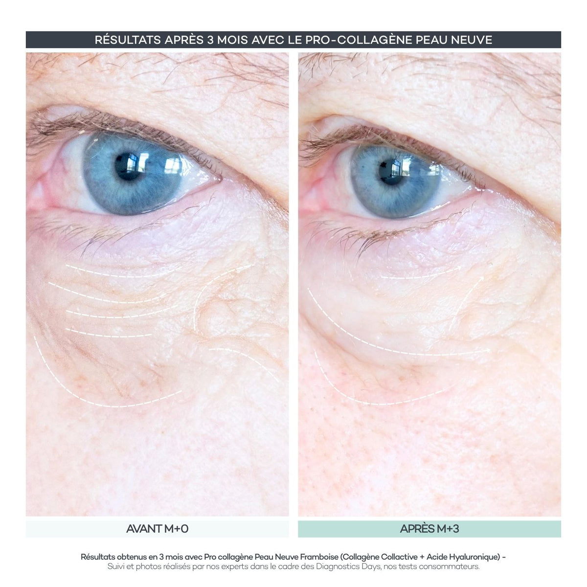 Pro-Collagen New Skin 28 Sticks