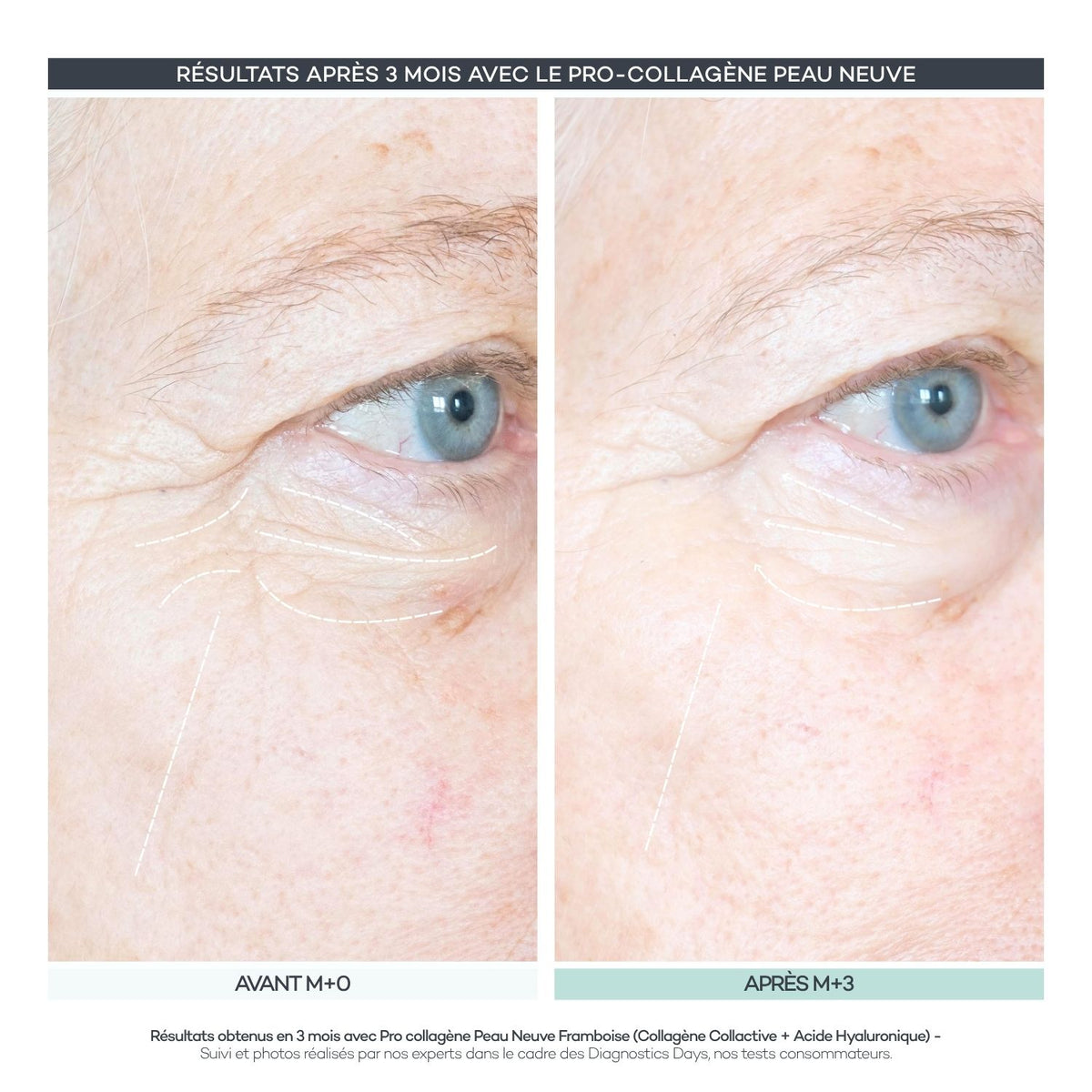 Pro-Collagen New Skin 28 Sticks