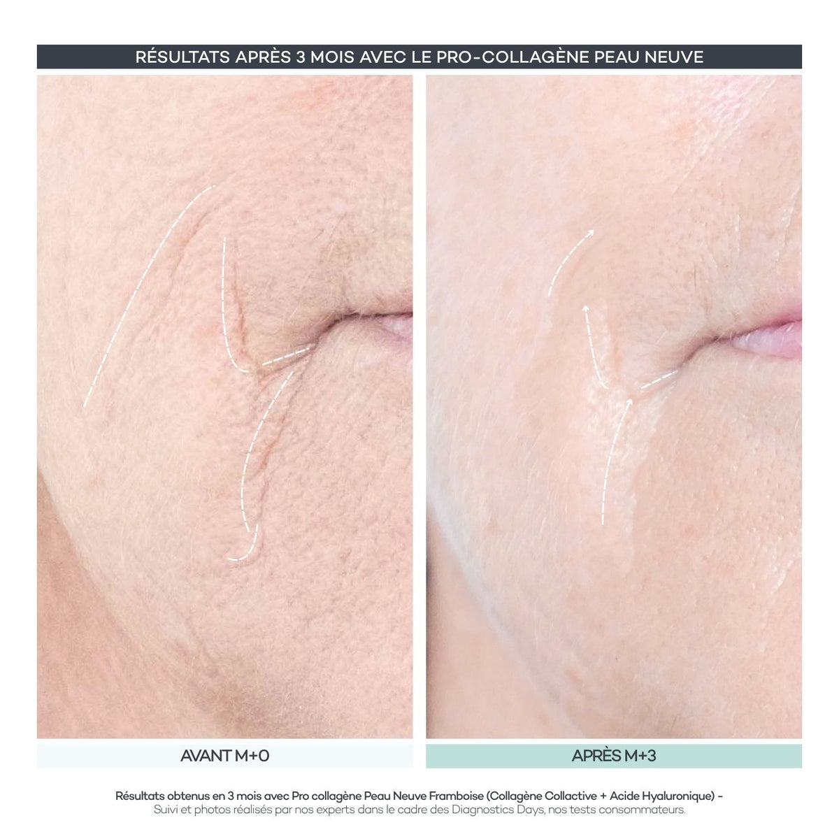 Pro-Collagen New Skin 28 Sticks