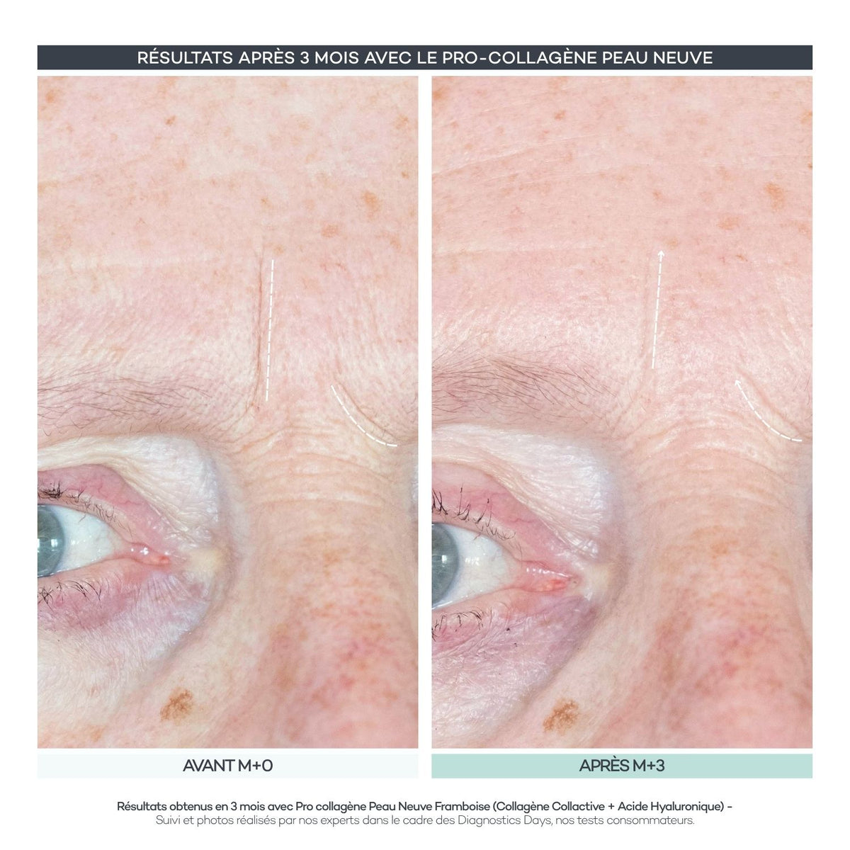 Pro-Collagen New Skin 28 Sticks