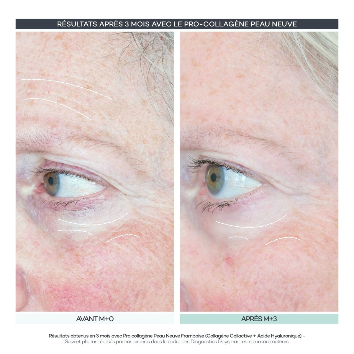 Pro-Collagen New Skin 28 Sticks