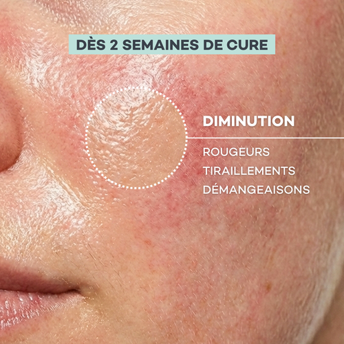 Sensitive Skin Routine