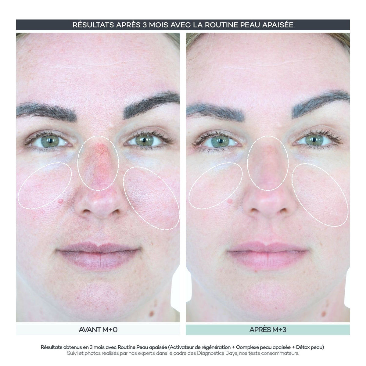 Soothed Skin Complex