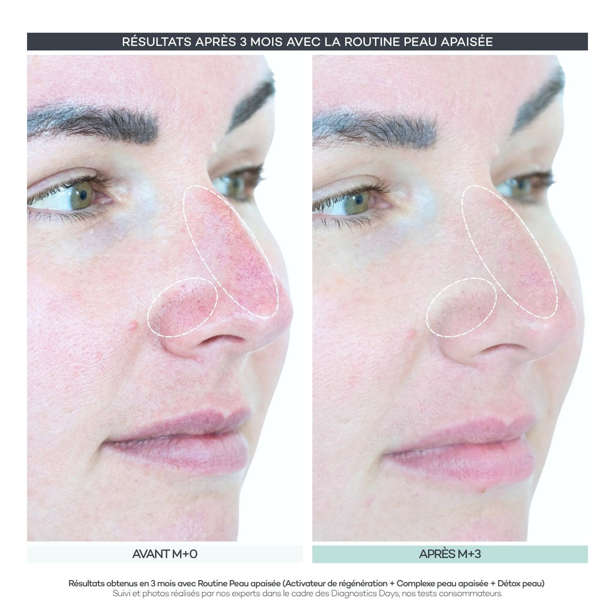 Soothed Skin Complex