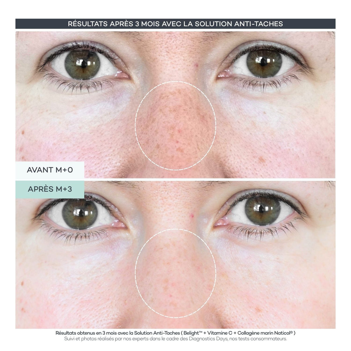 Anti-Spot Shots