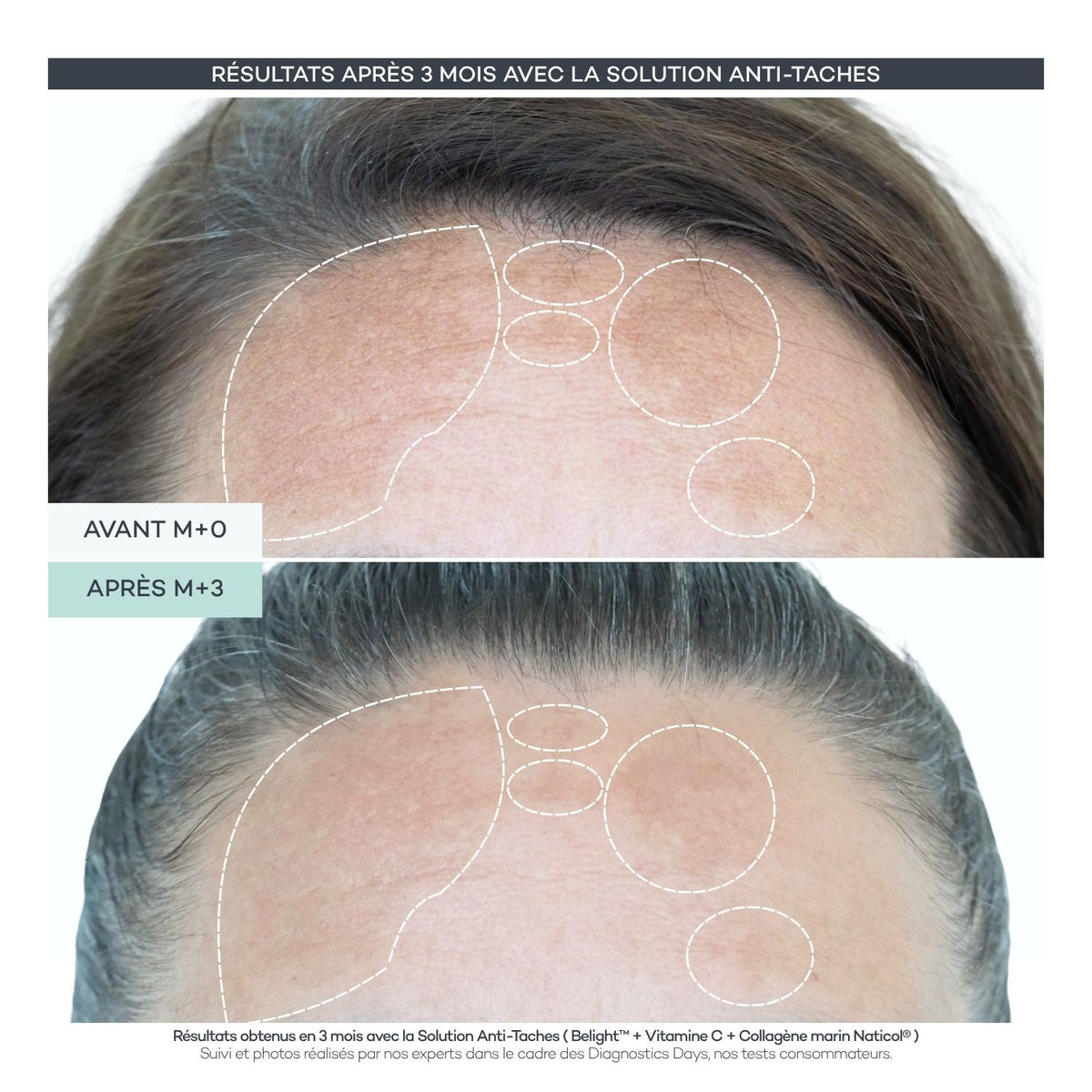 Anti-Spot Shots