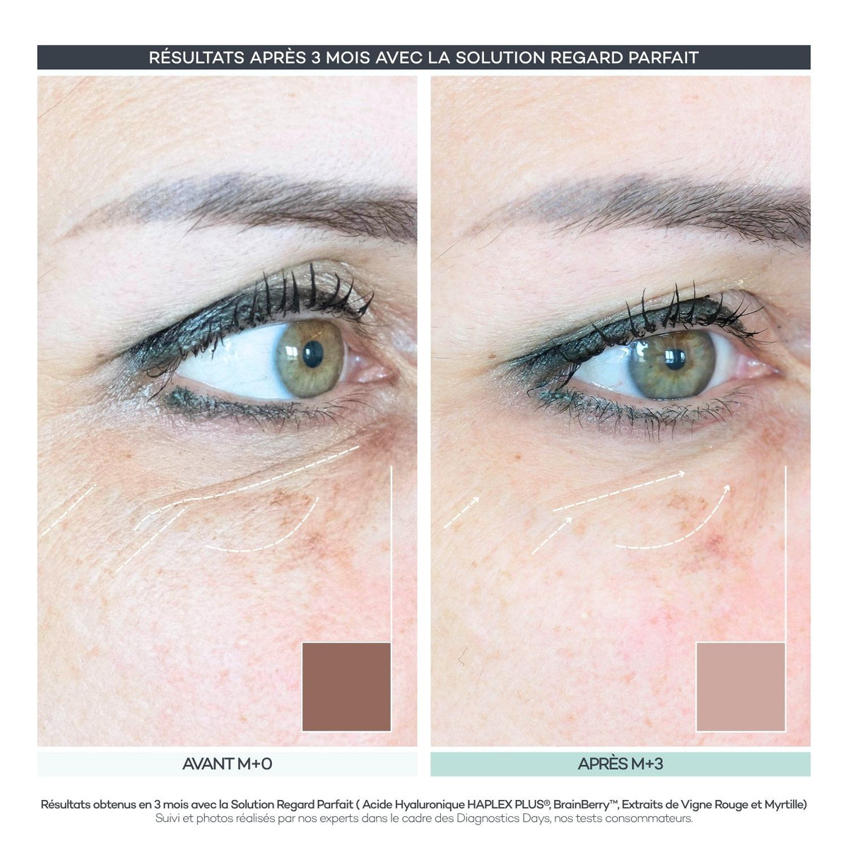 Perfect Regard Shots – Eye Contour