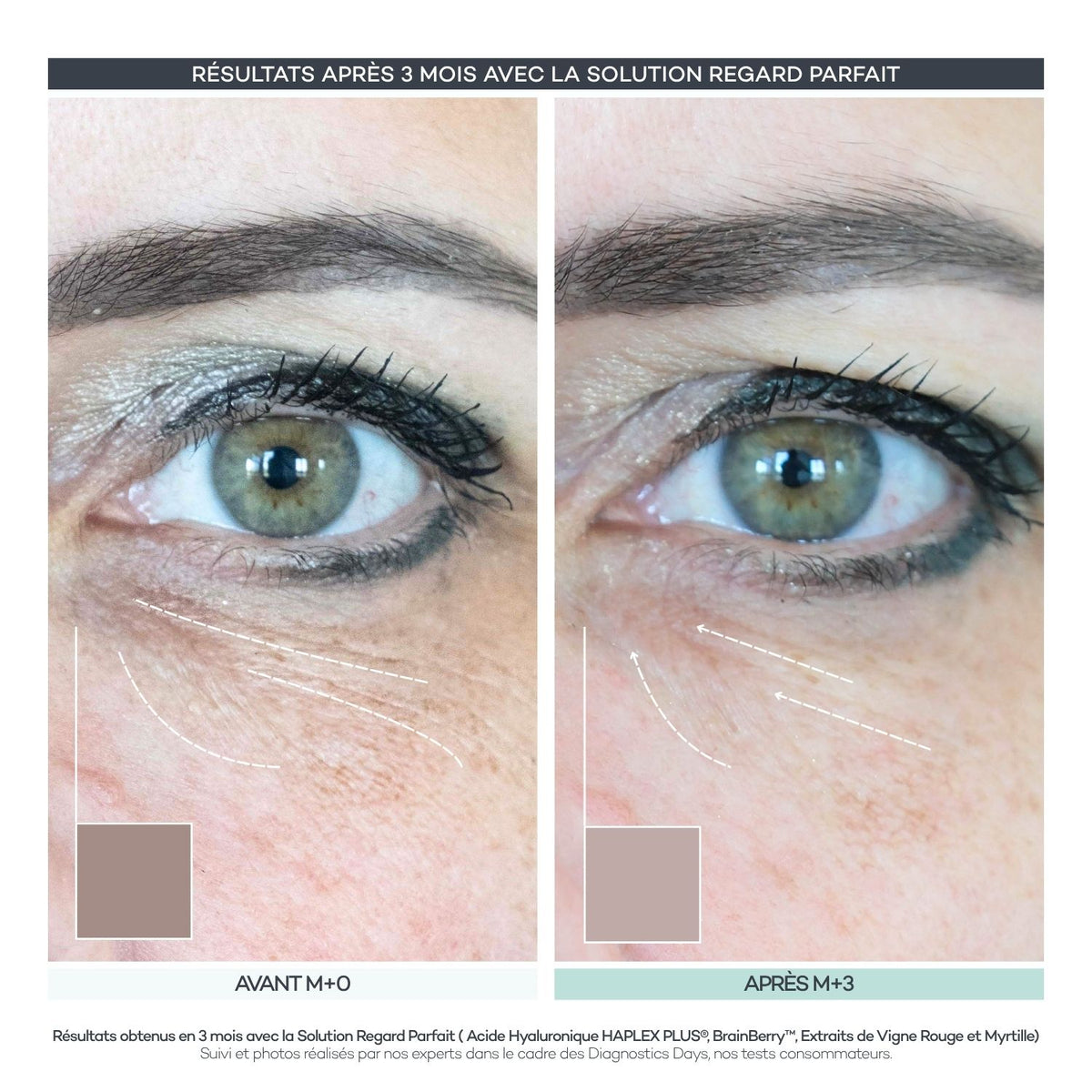 Perfect Regard Shots – Eye Contour