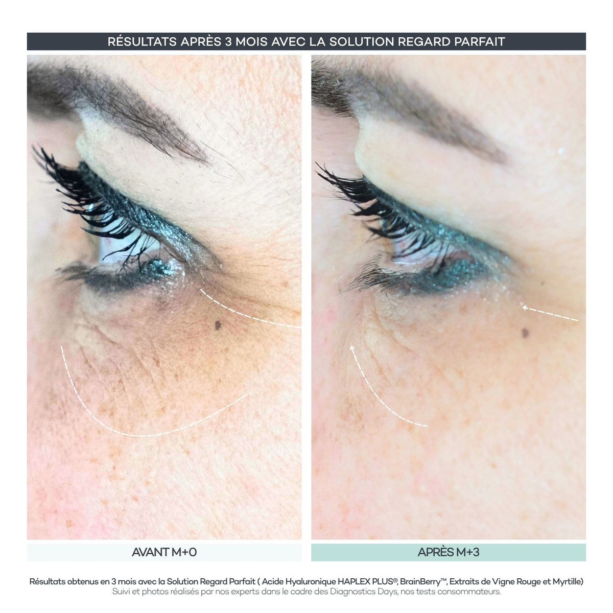 Perfect Regard Shots – Eye Contour