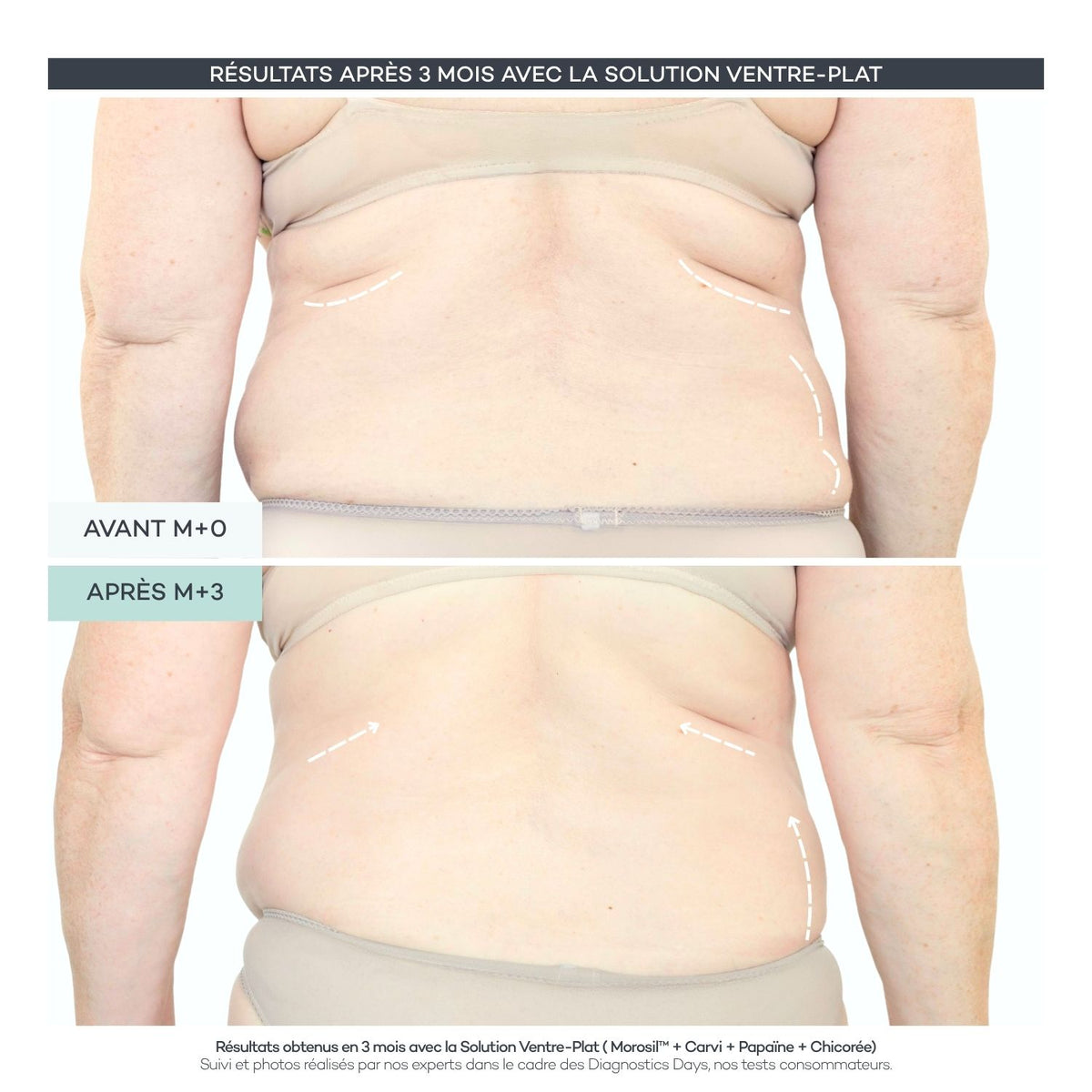 Flat-Stomach Solution – Body Reset