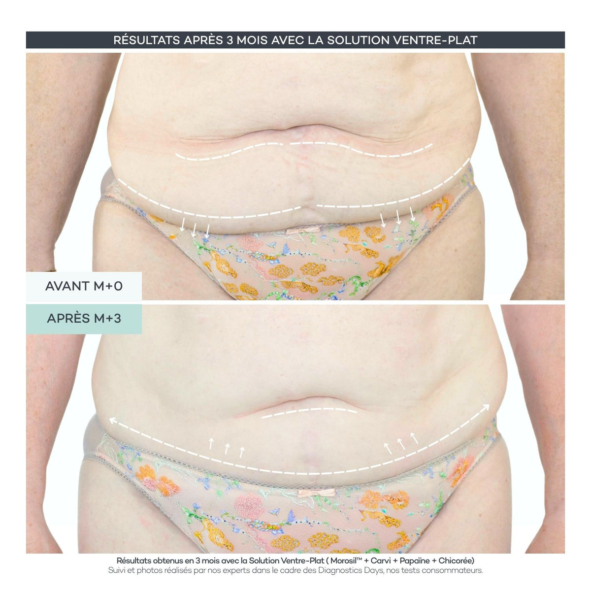 Flat-Stomach Solution – Body Reset