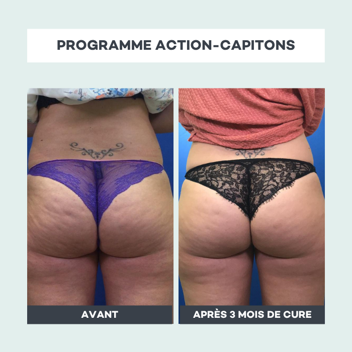 Routine Action-Capsules