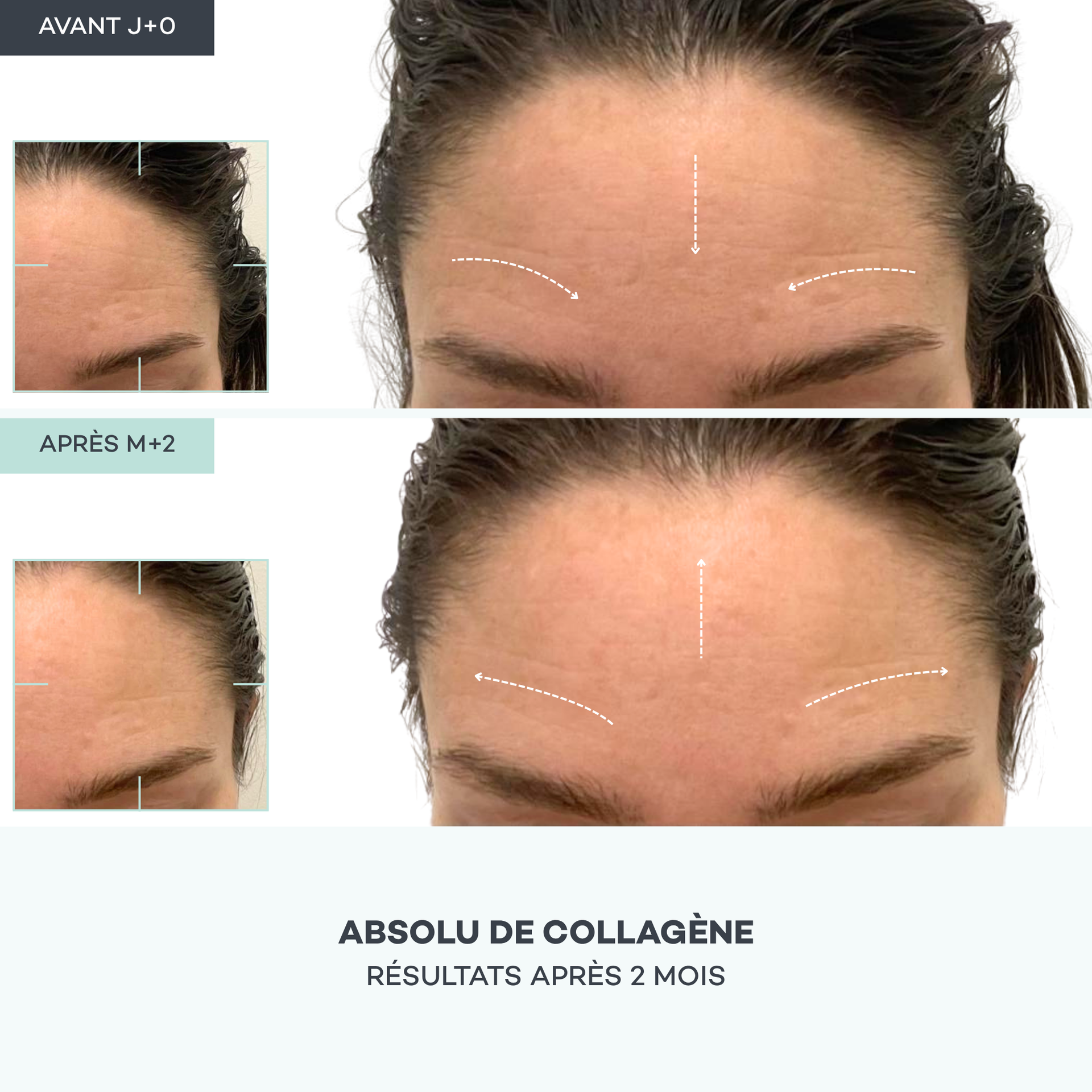 Collagen Absolute