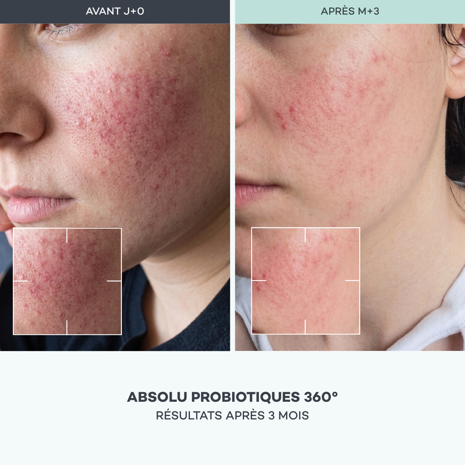 Absolu Probiotics 360°