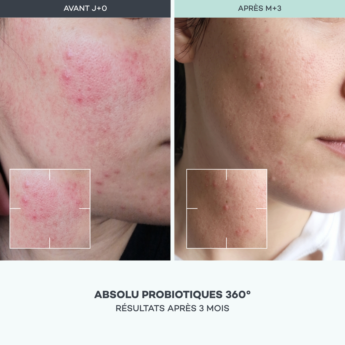 Absolu Probiotics 360°