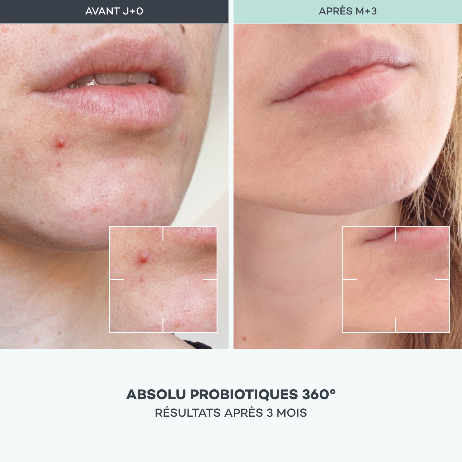 Absolu Probiotics 360°