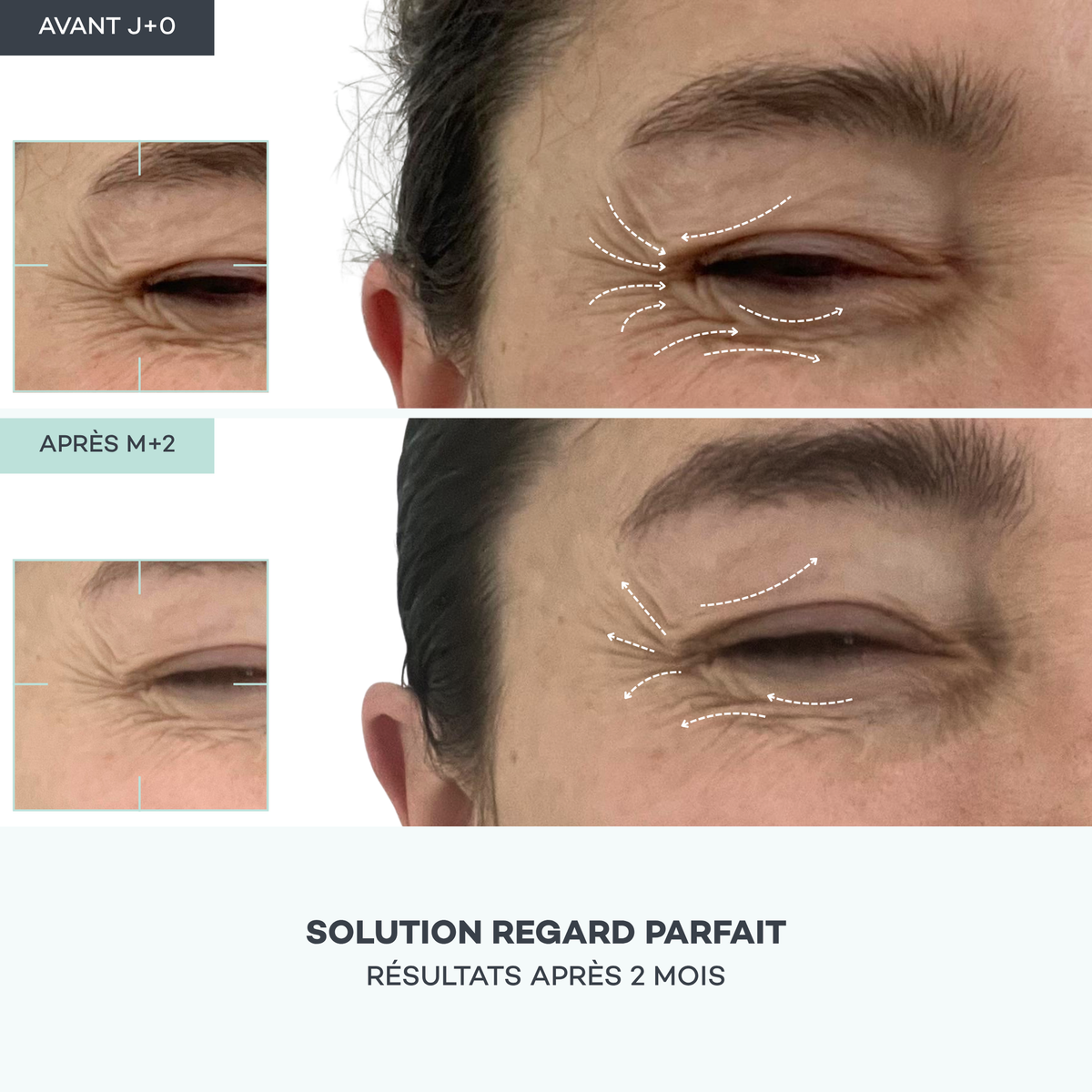 Perfect Regard Shots – Eye Contour