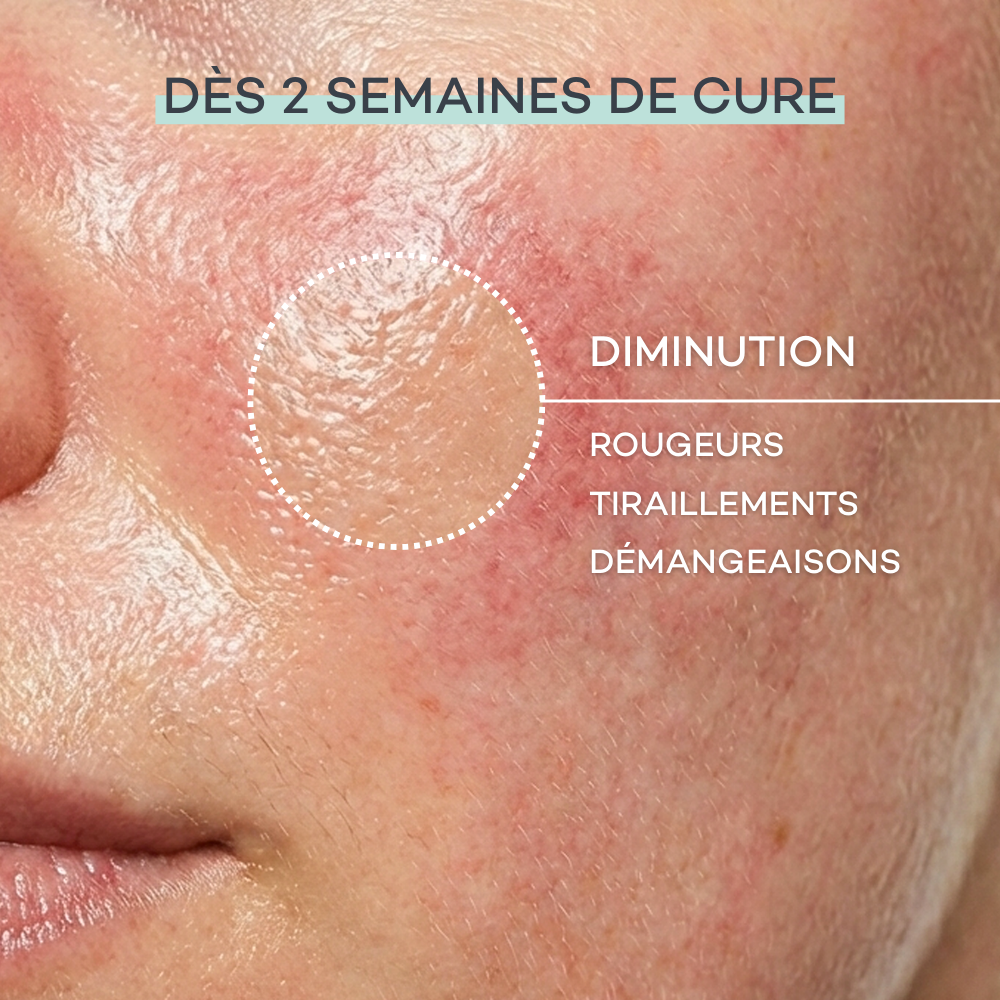 Sensitive Skin Routine