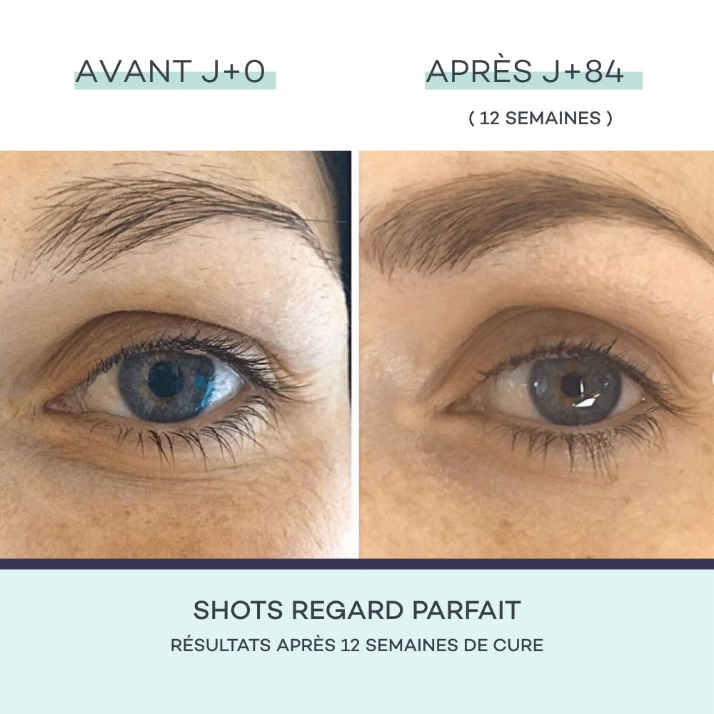 Eye Contour Shots
