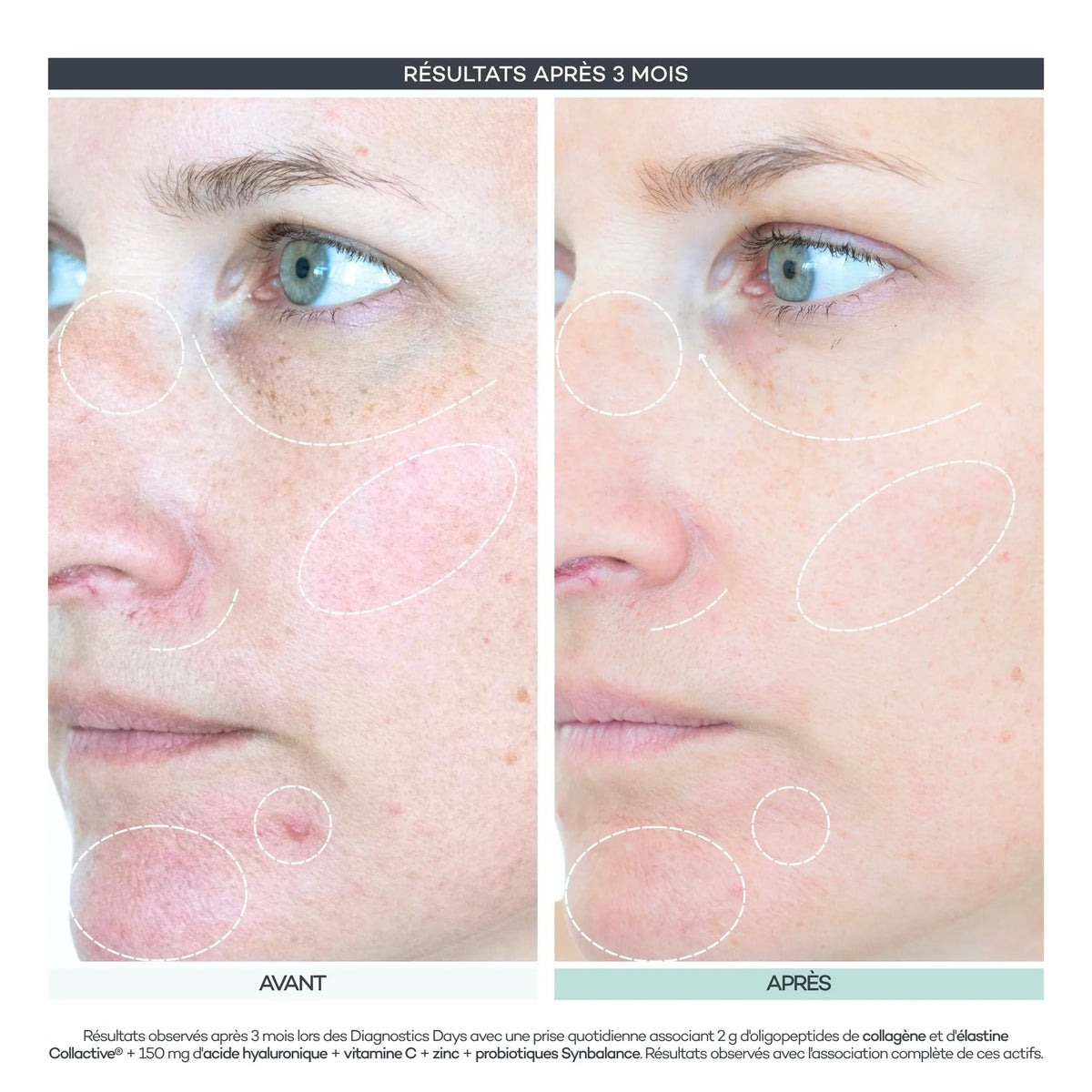 Avant / après 3 mois, teint et taches du visage. Résultats observés lors des Diagnostics Days D-LAB