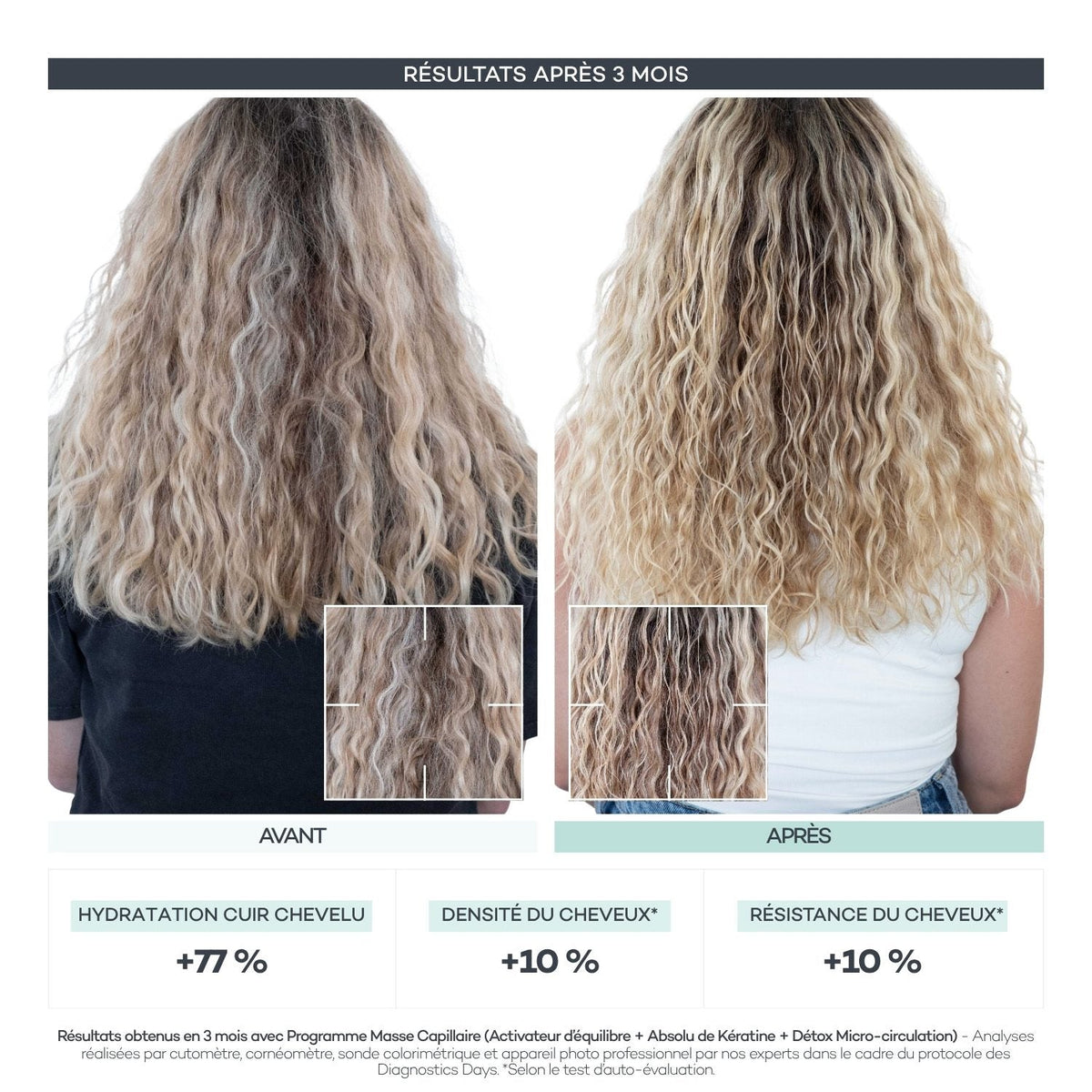 Résultats Diagnostics Days de la Routine Découverte Cheveux D-LAB sur la densité capillaire