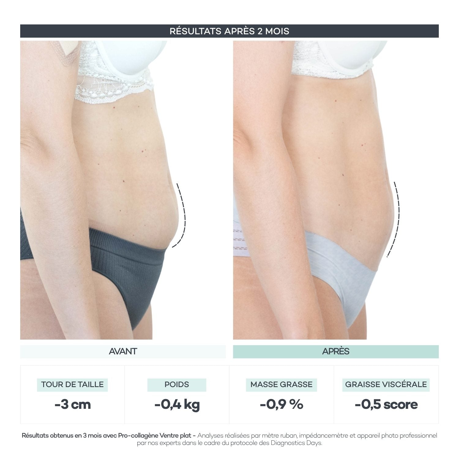 Avant/après Diagnostics Days — Coffret Minceur Mangue