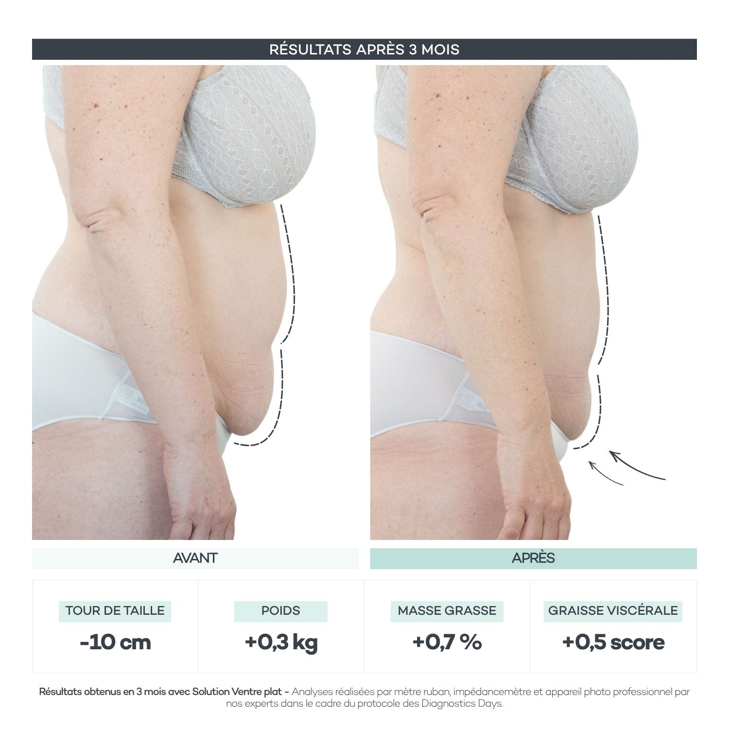 Avant/après Diagnostics Days — Ventre Plat