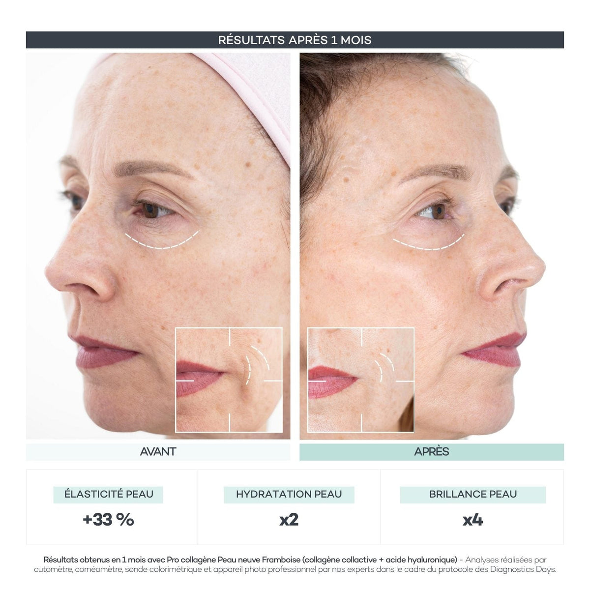 Avant après 1 mois de Routine Découverte Peau D-LAB de profil : +33% d'élasticité, hydratation doublée, brillance multipliée par 4