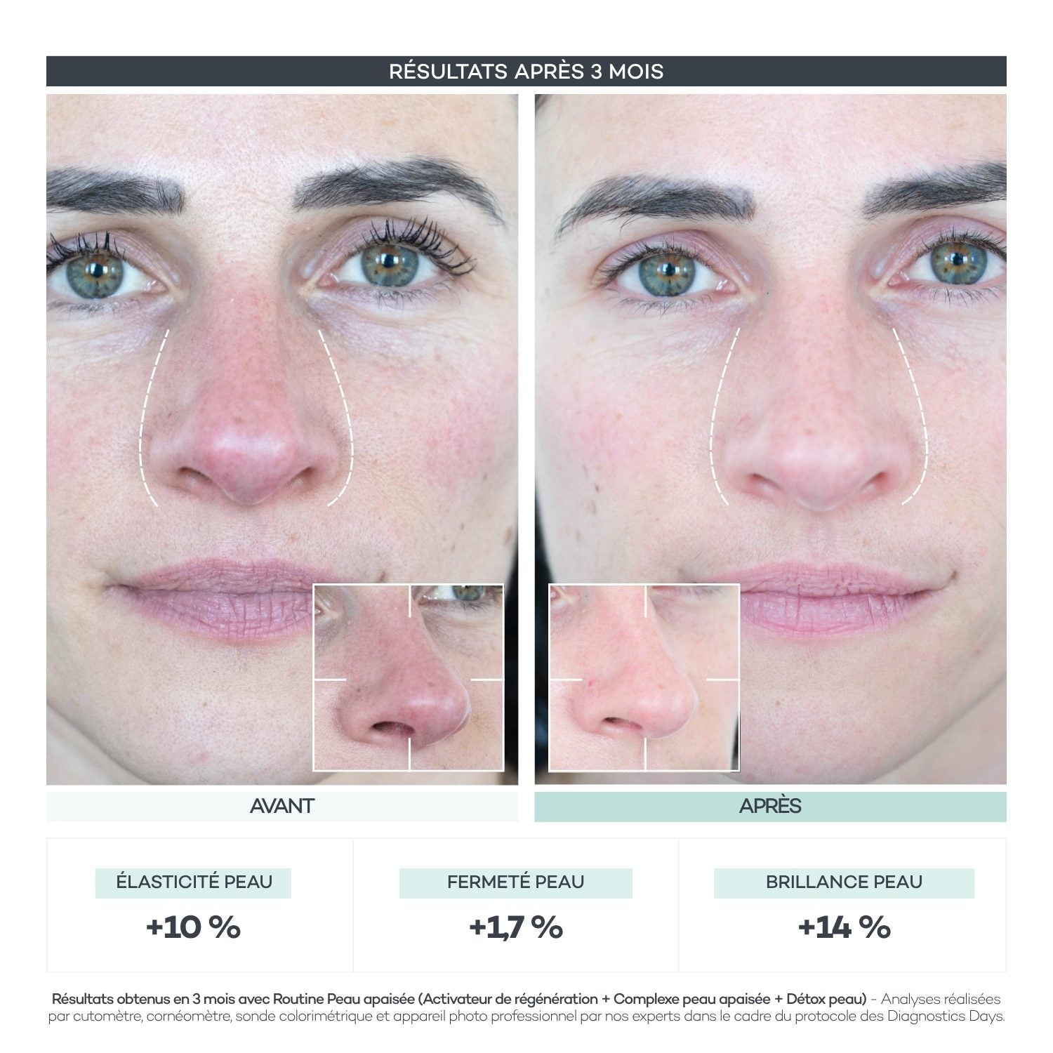 Avant/après Diagnostics Days — Peau Apaisée