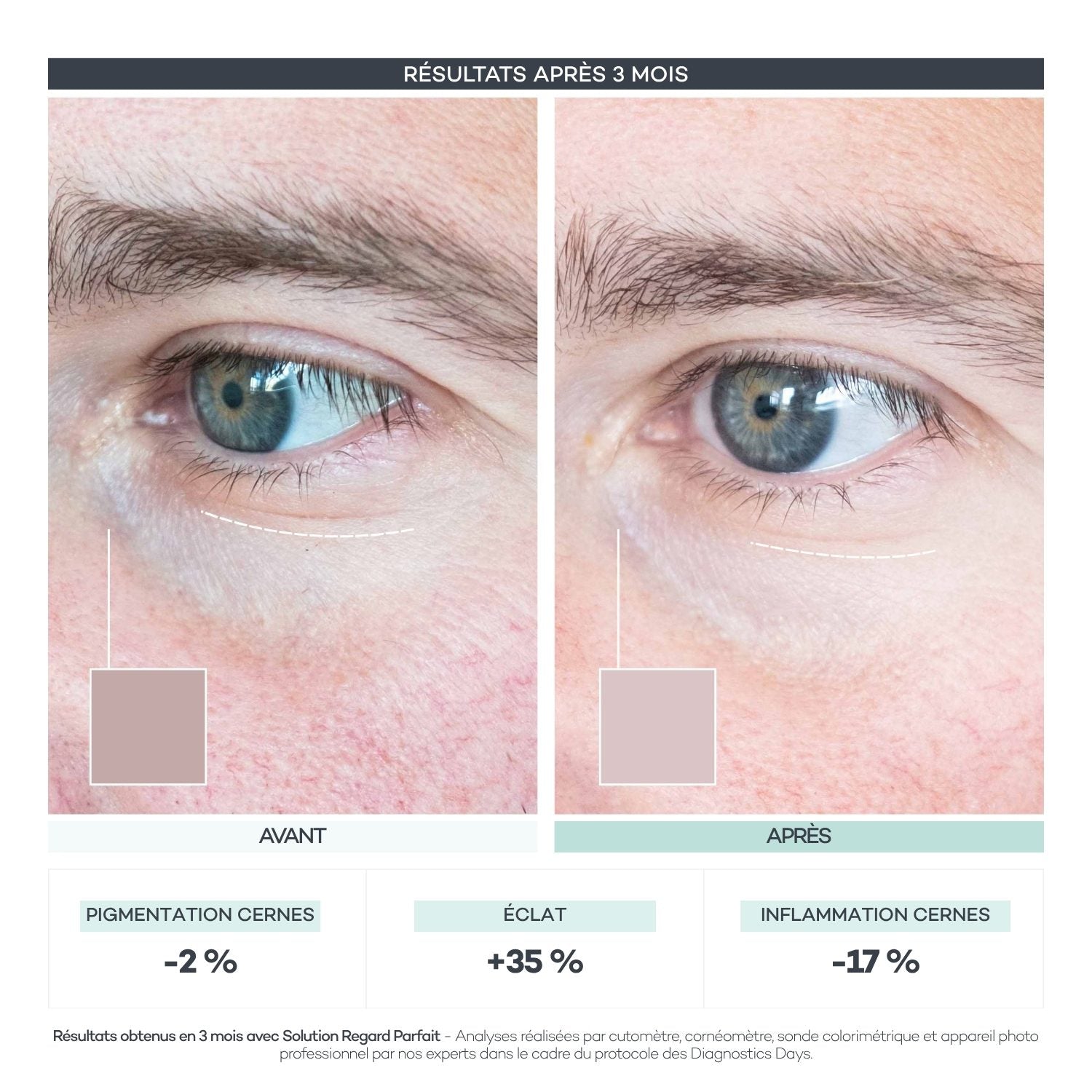 Avant/après Diagnostics Days — Regard Parfait