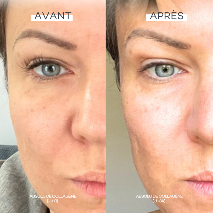 Absolute Shots of Collagen